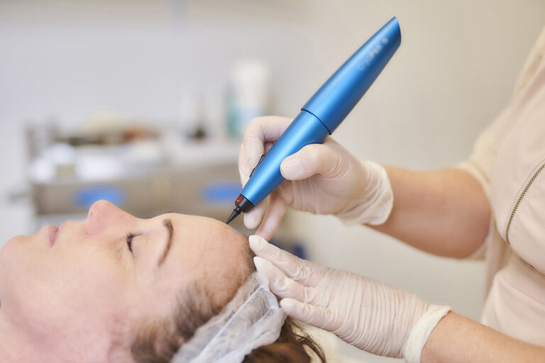 Understanding CryoPen Treatment: Effective Solutions for Skin Conditions