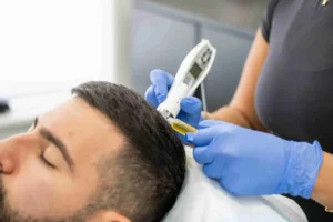 Hair growth treatment for hair loss and hair thinning in Beaconsfield